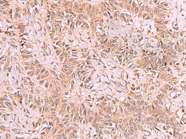 RRP8 Antibody