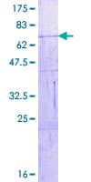 Human VIL1 / Villin Protein (Recombinant GST)
