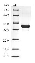 Human HBZ Protein (Recombinant GST, N-terminus)