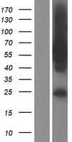 Human TBC1D22A Protein (Over-Expression Lysate Myc-DDK (Flag))