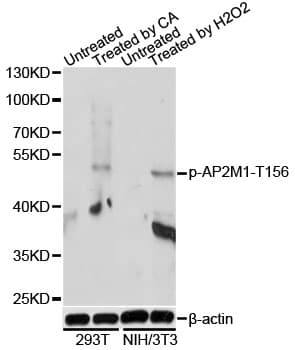 AP50 / AP2M1 Antibody (phospho-Thr156)