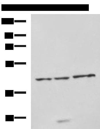 Polyclonal Rabbit anti-Human NDRG4 Antibody (IHC, WB)