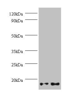 Polyclonal Rabbit anti-Human GEMIN7 Antibody (WB)