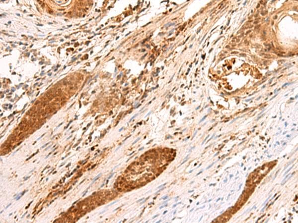 Polyclonal Rabbit anti-Human SCAND1 Antibody (IHC)