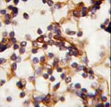 RICTOR Antibody (aa252-281)