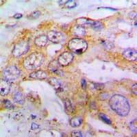 EIF4G1 / EIF4G Antibody (phospho-Ser1148)
