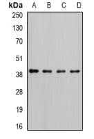 Polyclonal Rabbit anti-Human RFC4 Antibody (IHC, IF, WB)