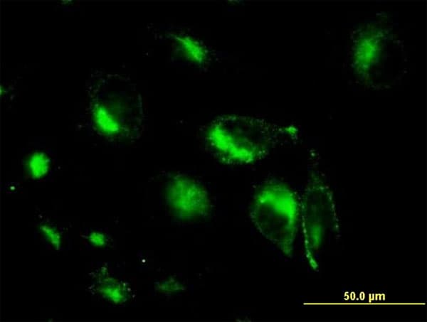 Monoclonal Mouse anti-Human STX6 / Syntaxin 6 Antibody (clone 1G2, IF, WB)