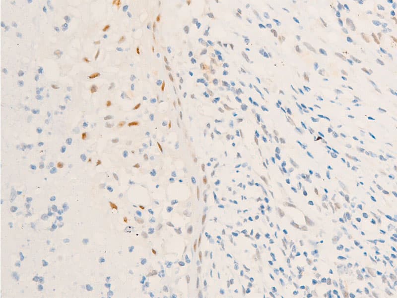 BIRC5 / Survivin Antibody (phospho-Thr117)