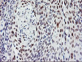 BACH1 Antibody (clone OTI4E11)