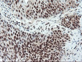 UBE2E3 Antibody (clone OTI7E8)