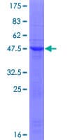 Human TIPRL / TIP Protein (Recombinant GST)