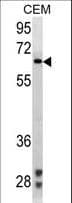ZAP70 Antibody