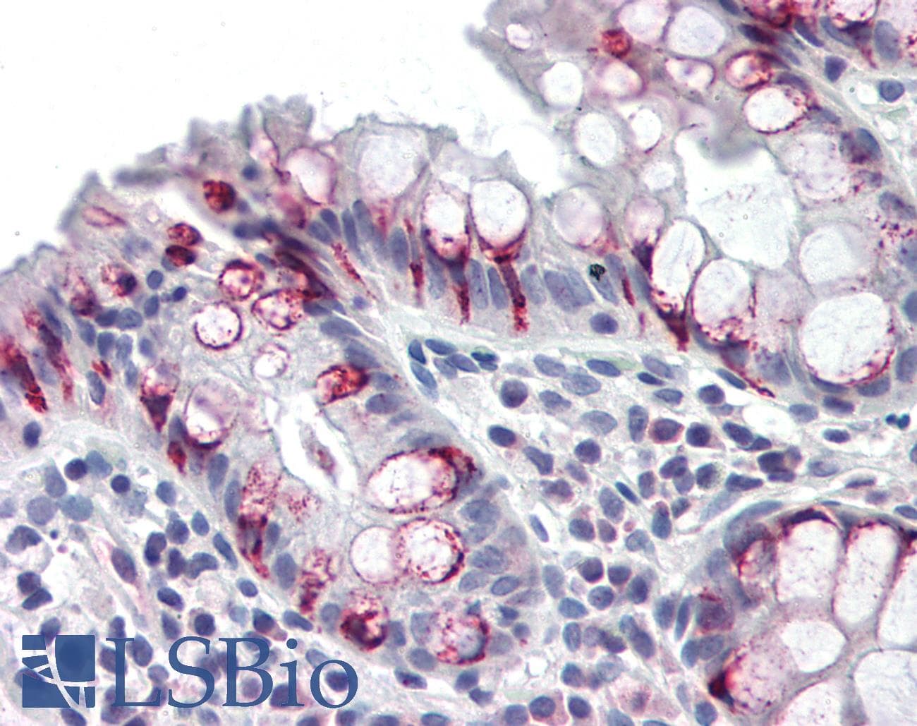 Polyclonal Rabbit anti-Human NCR2 / NKP44 Antibody (IHC, WB)