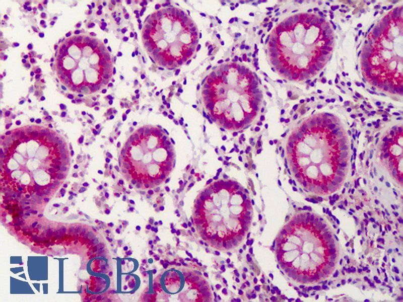 IHC-plus™ PPARD / PPAR Delta Antibody (aa39-54)