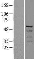 Human KRT7 / CK7 / Cytokeratin 7 Protein (Over-Expression Lysate Myc-DDK (Flag))