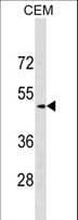 SCG3 / Secretogranin 3 Antibody (aa378-406)