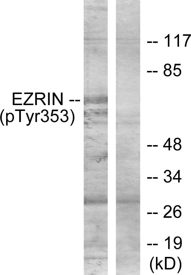 Polyclonal Rabbit anti-Human EZR / Ezrin Antibody (phospho-Tyr353, WB)