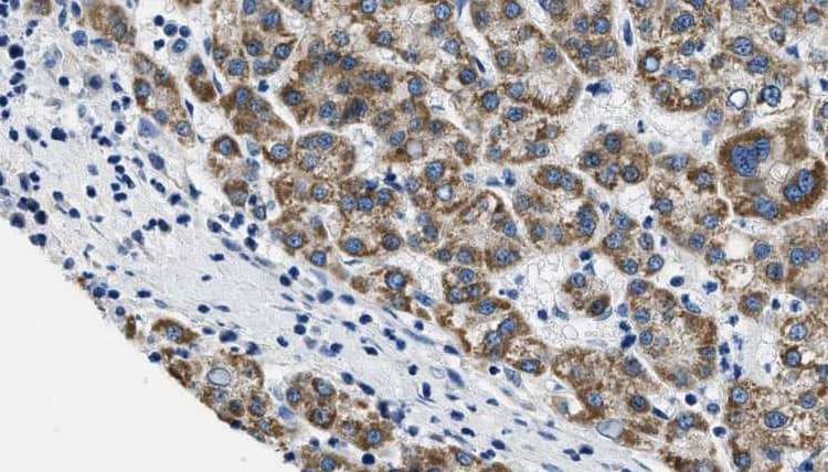 Polyclonal Rabbit anti-Human SLC2A4 / GLUT-4 Antibody (IHC, WB)