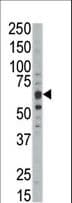 DYRK1B Antibody (aa561-589)