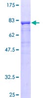 Human Properdin / CFP Protein (Recombinant GST)