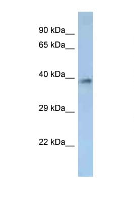 OR2M2 Antibody (aa238-287)