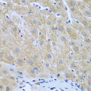 FURIN Antibody