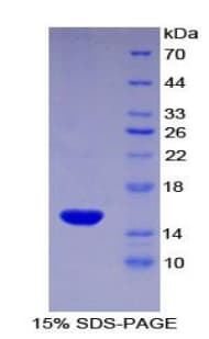Rat CD55 Protein (Recombinant His)