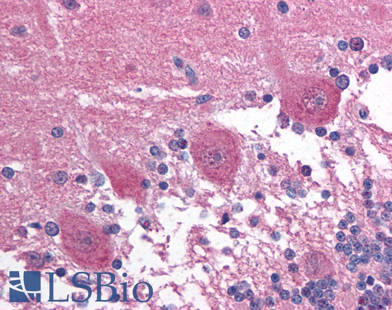Polyclonal Rabbit anti-Human PAX3 Antibody (aa400-449, IHC, WB)