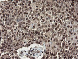 Mannose Phosphate Isomerase Antibody (clone OTI4G7)