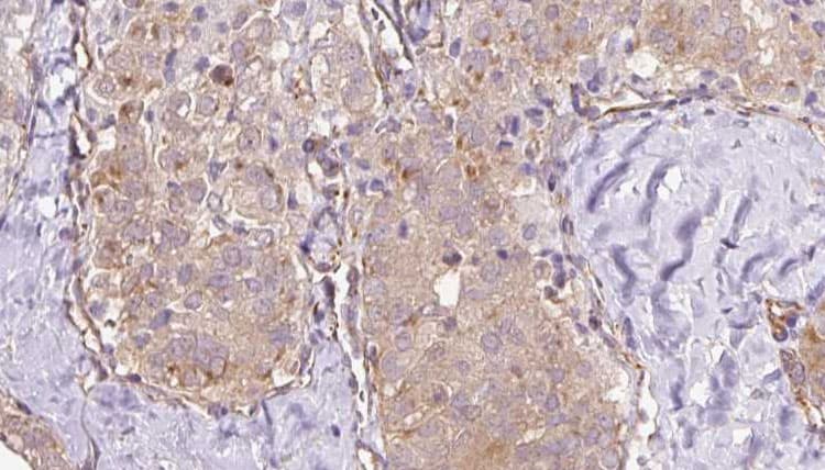 TRPC4AP / TRUSS Antibody
