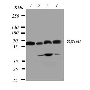 SQSTM1 Antibody (aa91-110)