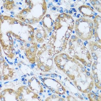 Polyclonal Rabbit anti-Human ARHGEF5 Antibody (IHC)