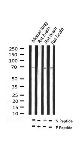 EZR / Ezrin Antibody (phospho-Thr566)