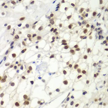Polyclonal Rabbit anti-Human MSH6 Antibody (IHC, IF, WB)