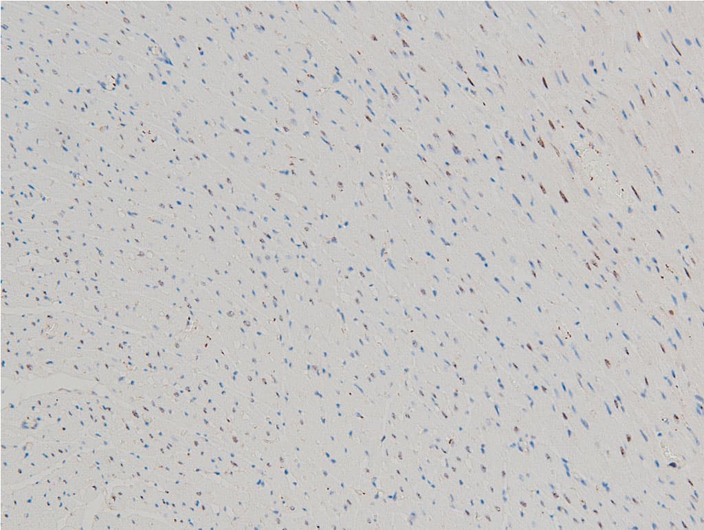 CFL1 / Cofilin Antibody (phospho-Ser3)
