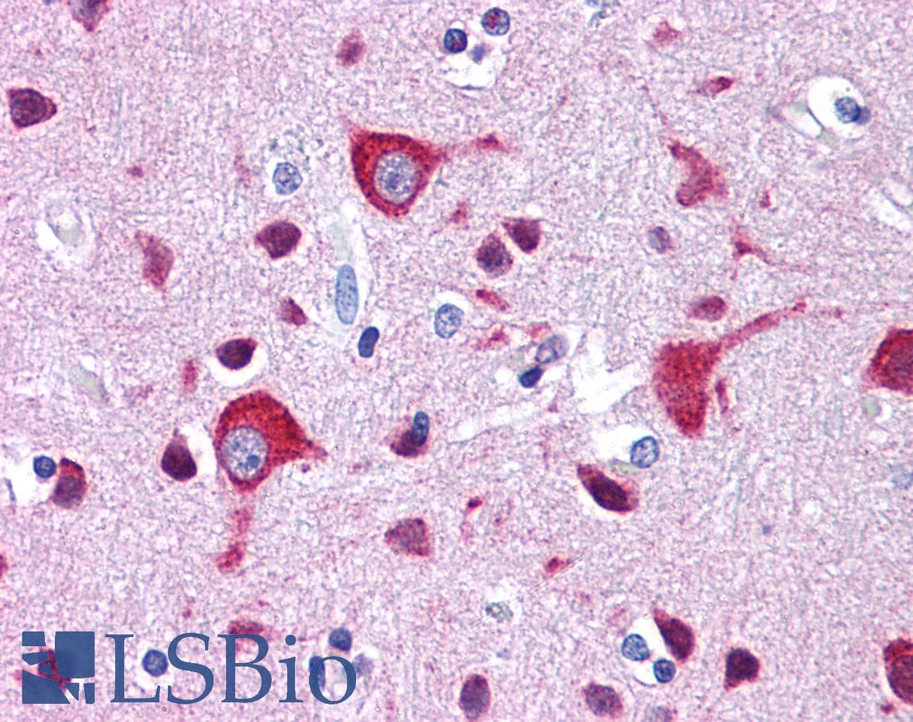 IHC-plus™ ZEB2 / SIP-1 Antibody