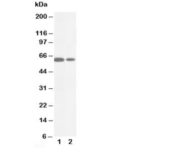 MMP16 Antibody (aa582-598)