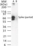 SARS-CoV Spike Glycoprotein Antibody (aa19-35)
