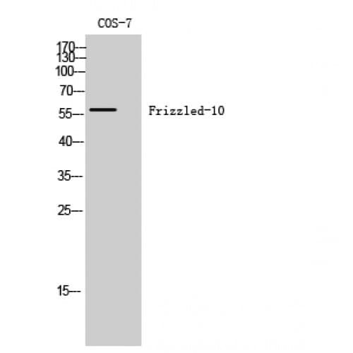Polyclonal Rabbit anti-Human FZD10 / Frizzled 10 Antibody (110-190 aa, Internal, IHC, IF, WB)