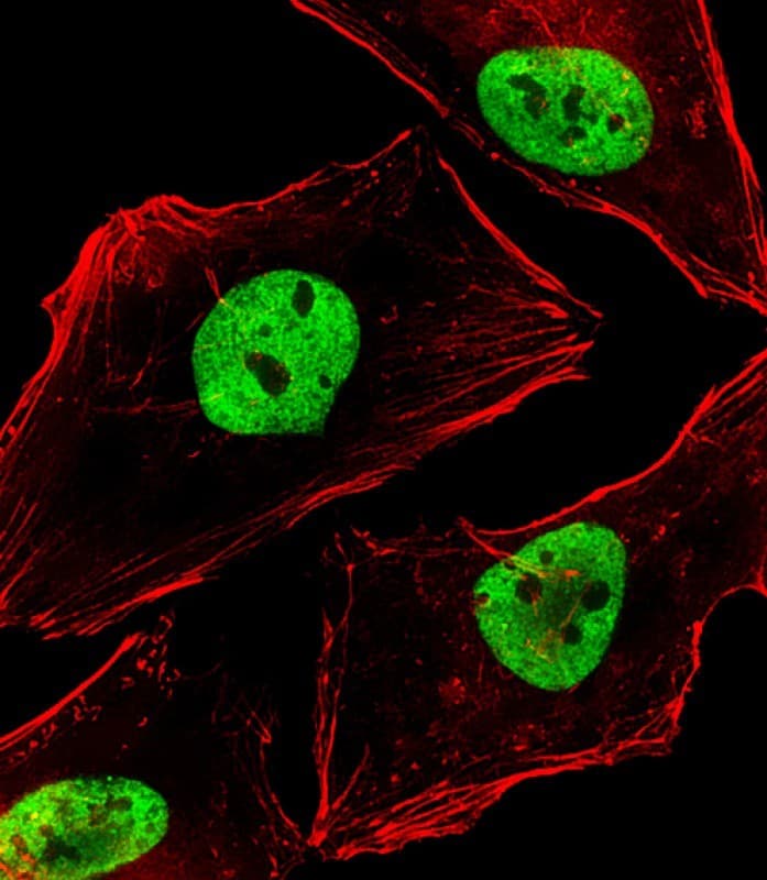 BCL9 Antibody (aa272-304)
