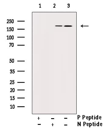 PDGFRB / PDGFR Beta Antibody (phospho-Tyr740)