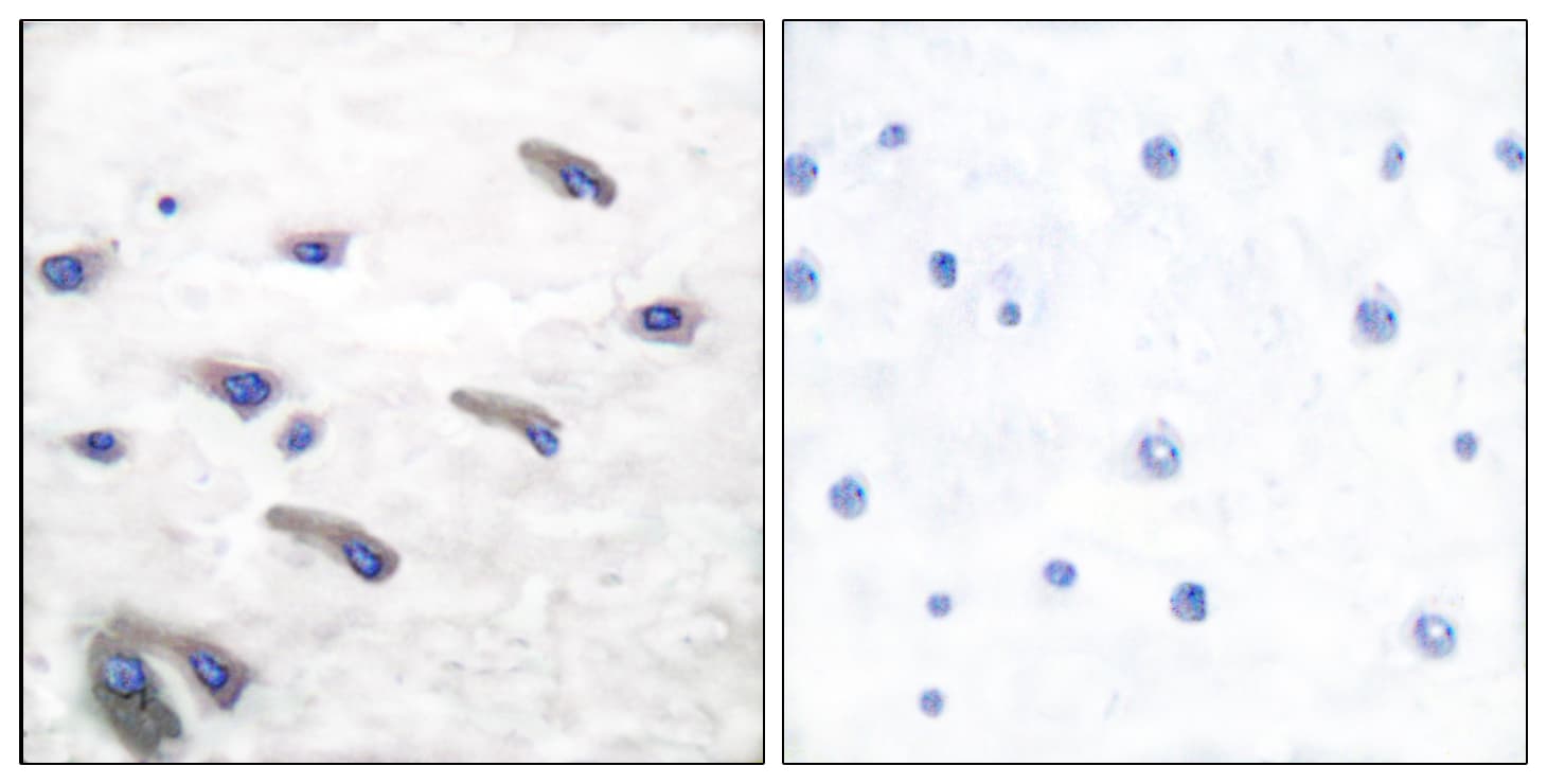 PDGFRB / PDGFR Beta Antibody (phospho-Tyr751)