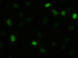IHC-plus™ AKT3 Antibody (clone 9H8)