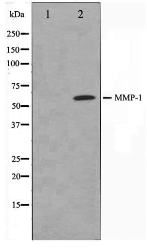 Polyclonal Rabbit anti-Human MMP1 Antibody (WB)
