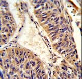 ALG14 Antibody (aa67-93)