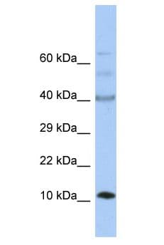 UFSP1 Antibody (aa91-140)