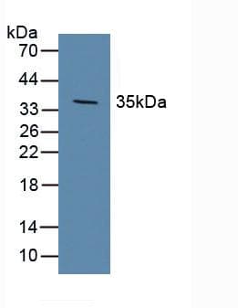 DKK1 Antibody (aa33-266)