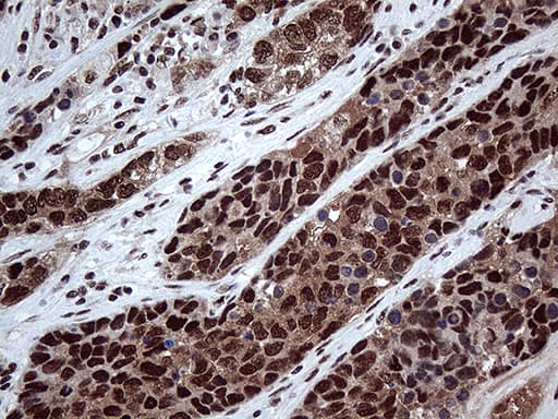 Monoclonal Mouse anti-Human PPP4C Antibody (clone OTI2E4, Carrier-free, IHC, WB)