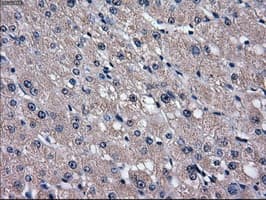 SLC2A5 / GLUT5 Antibody (clone OTI20E1)